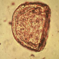 Tapeworm egg as it appears in a microscopic fecal egg count