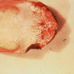 Close-up of a parasite under a microscope.