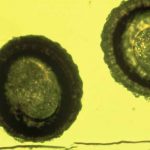 Microscopic view of two pollen grains with textured surfaces.