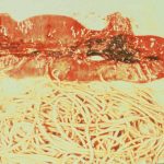 Microscopic view of parasitic worms in tissue.