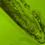 Microscopic view of algae cells with internal structures visible.