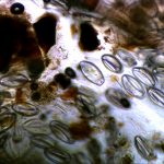 Microscopic view of fungal spores and hyphae under a microscope.